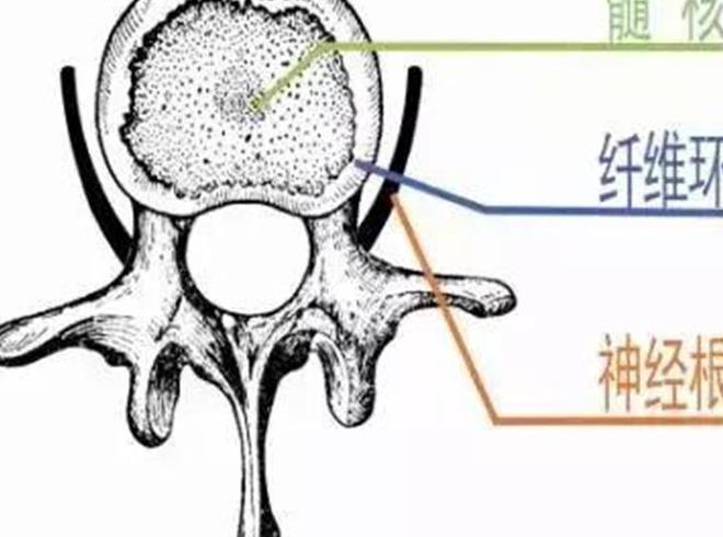 澳门威斯尼斯wns675入口瑜伽教练因长期教习瑜伽导致腰椎间盘突出医生：严重点会(图3)