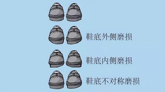 澳门威斯尼斯为什么体态不好？看完这些对比图我才发现：原来是走错了“路”(图14)